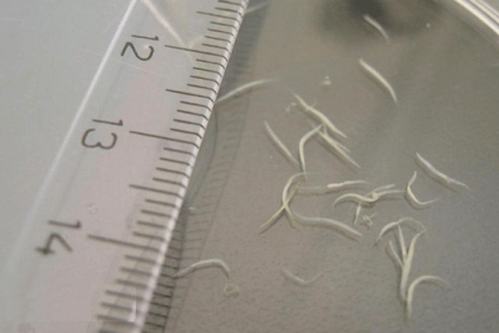 how to remove pinworms from a child