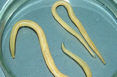roundworms from the body of a child