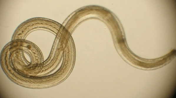 parasitic worm from the human body