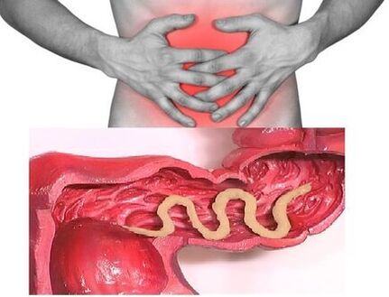 signs of chronic helminthiasis are dyspeptic intestinal disorders
