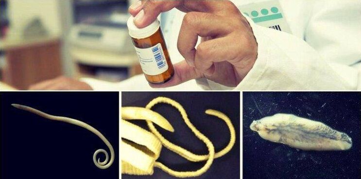 Types of worms and a medicinal method to get rid of them